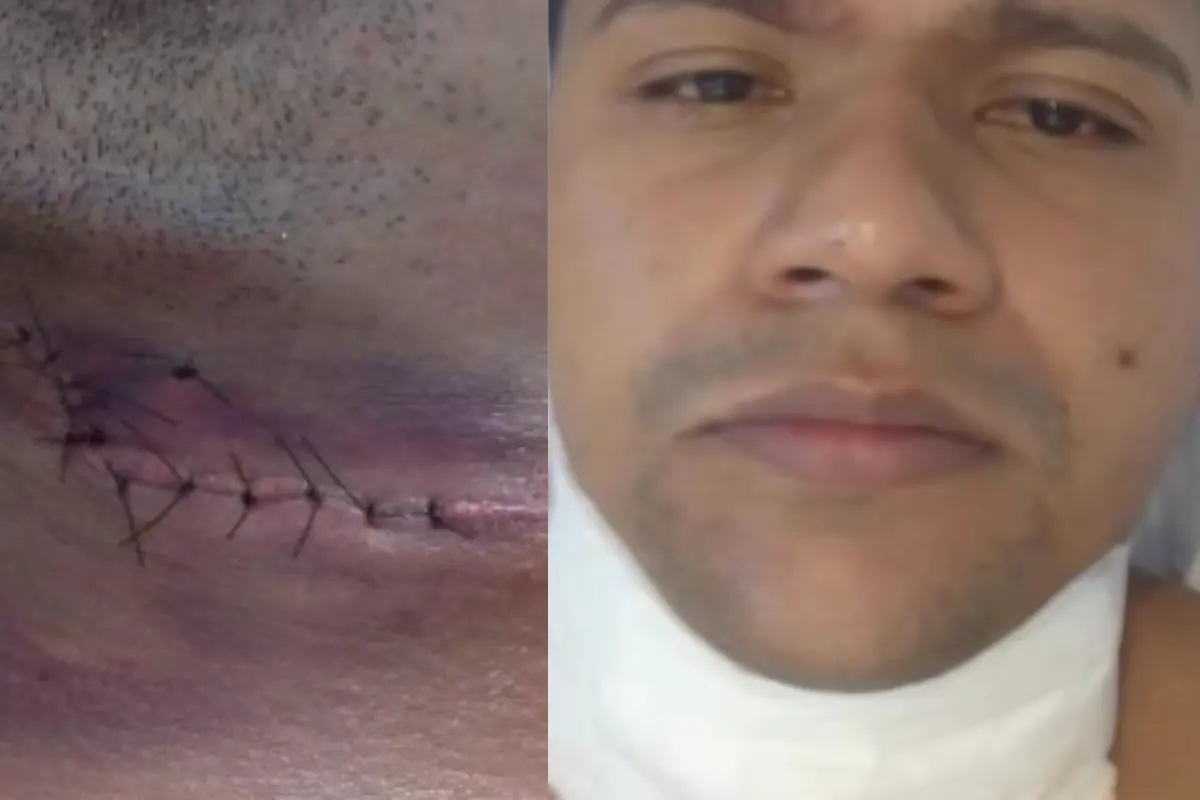 Homem sofre corte profundo no pescoço após ser atingido por linha de pipa em Cacoal